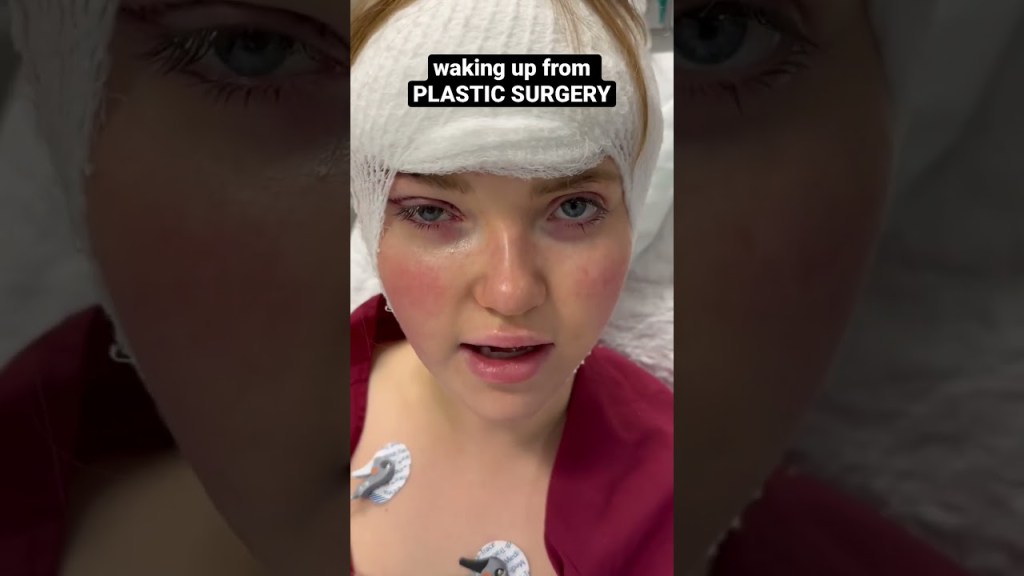 waking up from PLASTIC SURGERY #fashion #beauty&nbsp;#plasticsurgery